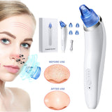 Electronic Blackhead Remover Vacuum Extractor